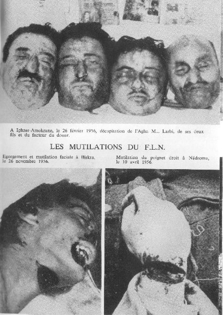 http://www.algerie-francaise.org/tortures/photos/tortures1.jpg